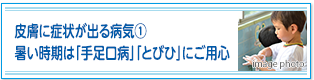 皮膚に症状が出る病気①暑い時期は「手足口病」「とびひ」にご用心