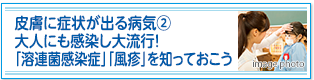 皮膚に症状が出る病気②大人にも感染し大流行！「溶連菌感染症」「風疹」を知っておこう