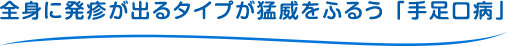 全身に発疹が出るタイプが猛威をふるう「手足口病」